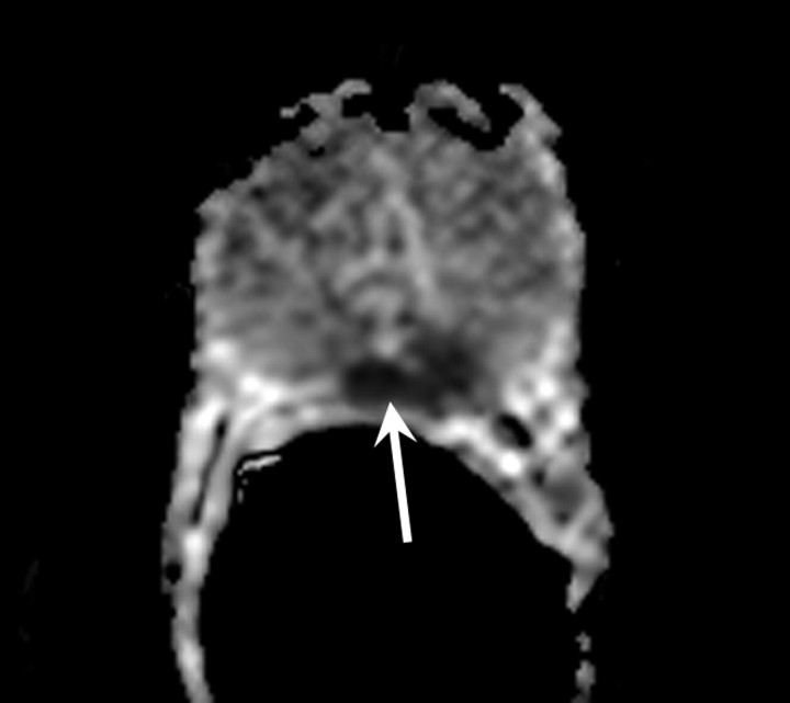 Figure 10b: