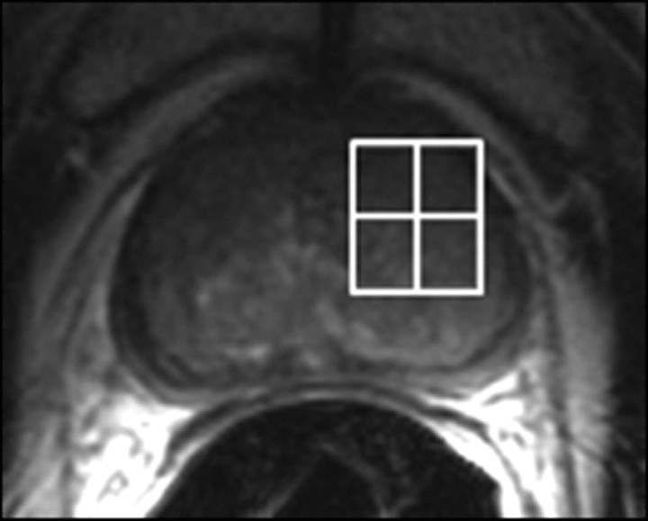 Figure 14a: