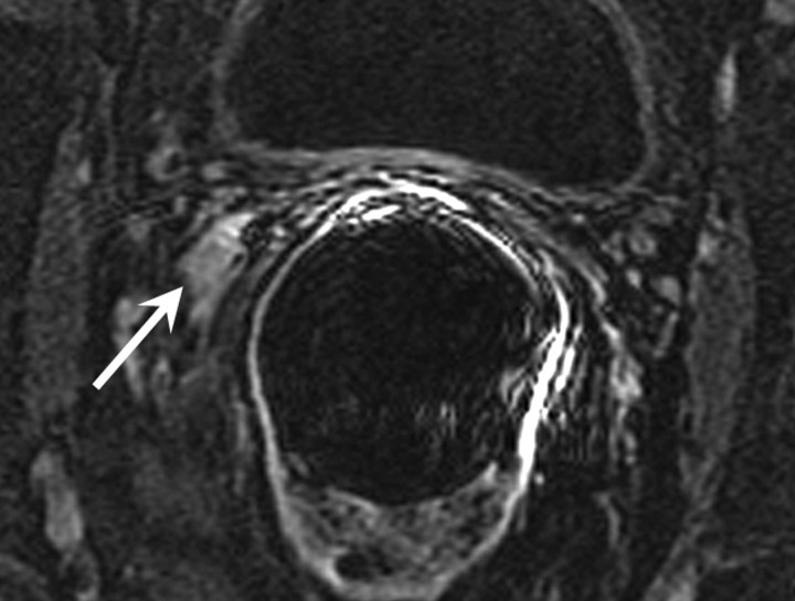 Figure 5b: