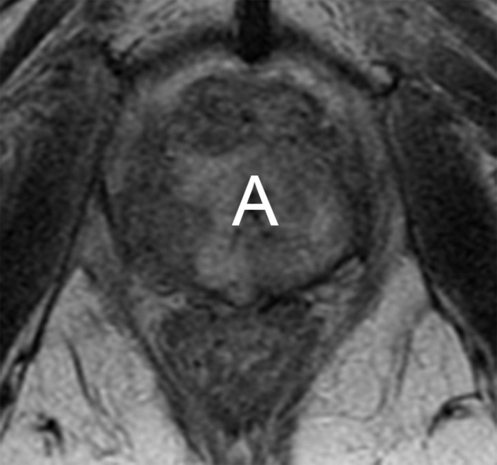 Figure 3c: