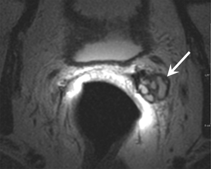 Figure 2b: