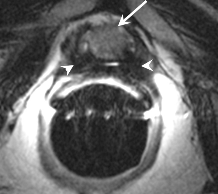 Figure 18a: