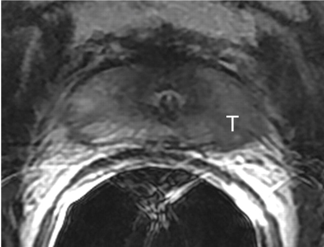 Figure 11a: