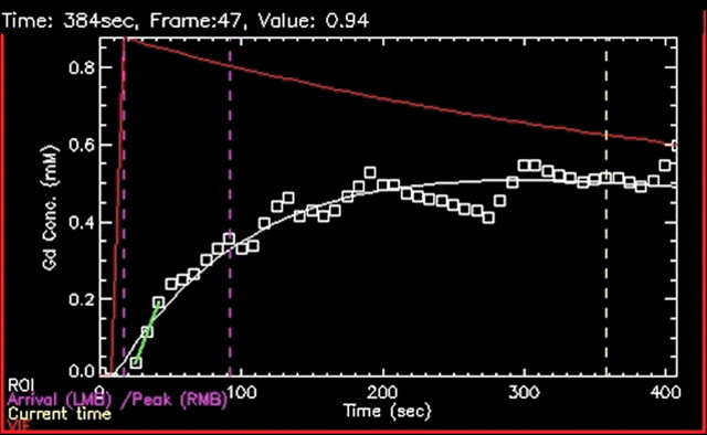 Figure 11d: