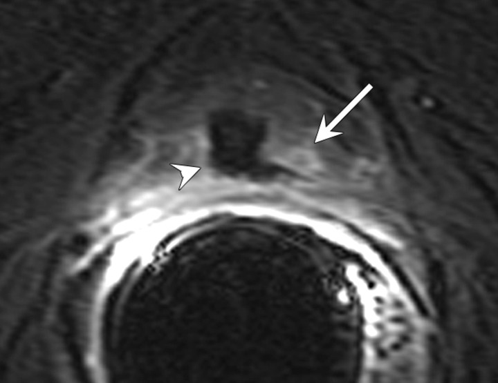 Figure 19b: