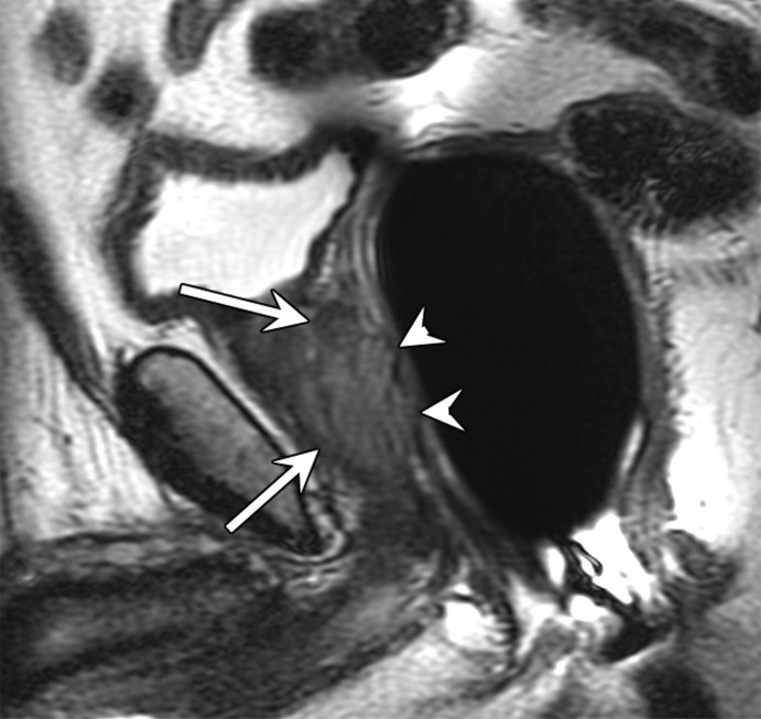 Figure 15b: