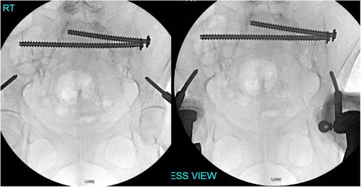 Fig. 11