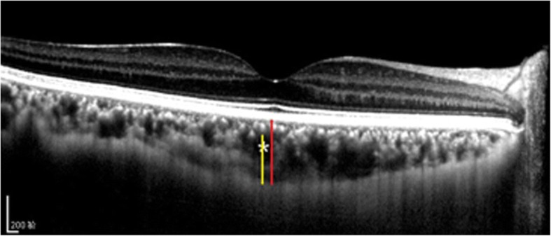 Fig. 3