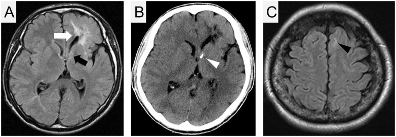 Fig 3