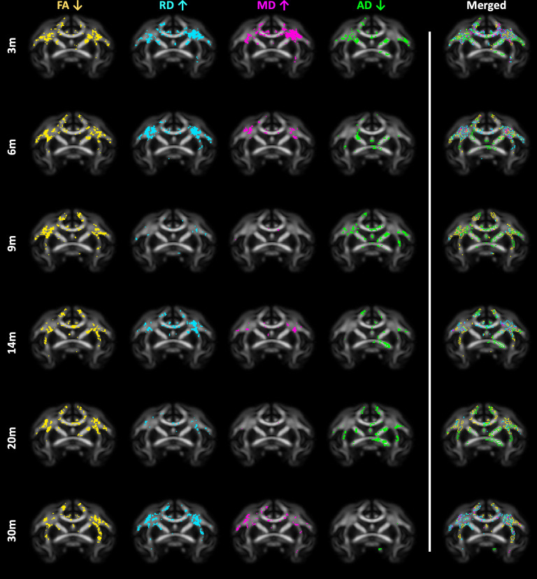 Figure 2—figure supplement 4.