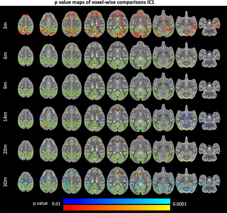 Figure 4—figure supplement 3.