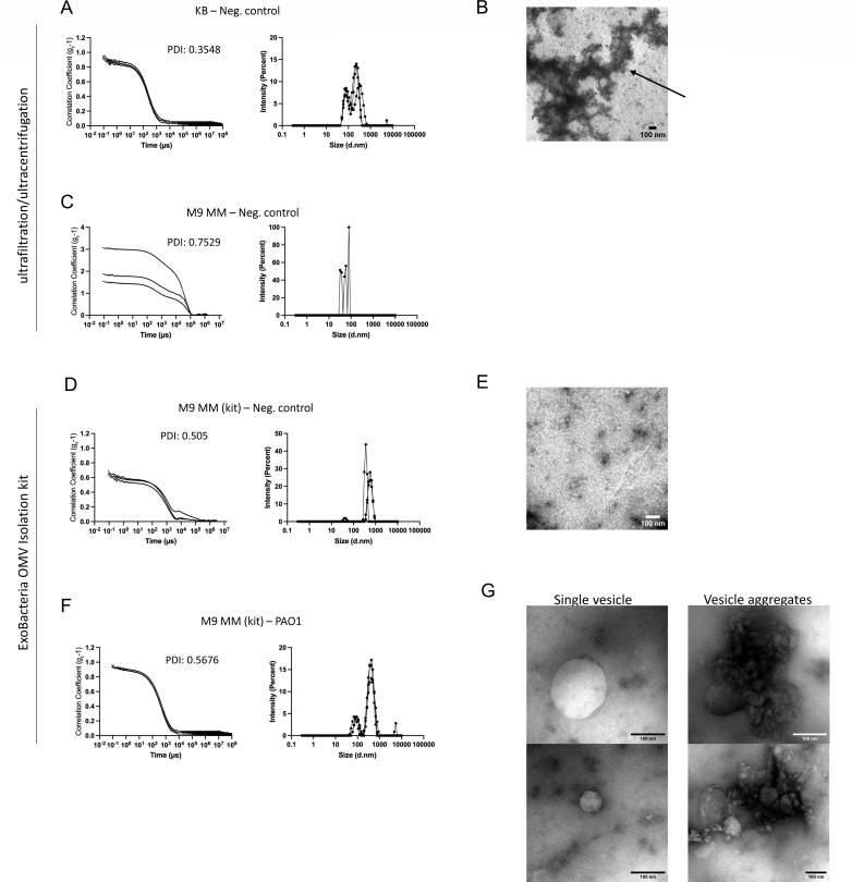 Experimental data on particle size distribution and aspect of vesicles isolated using ultrafiltration and OMV isolation kit methods. It includes graphs of correlation coefficients, size distribution and microscopic images of vesicles and its aggregates.