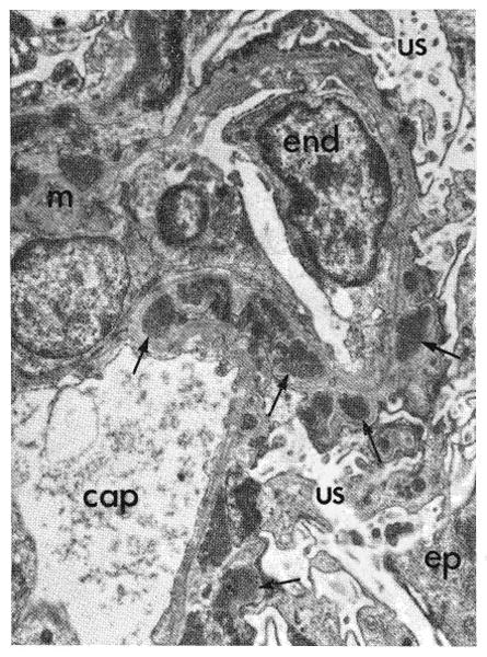 Fig. 18