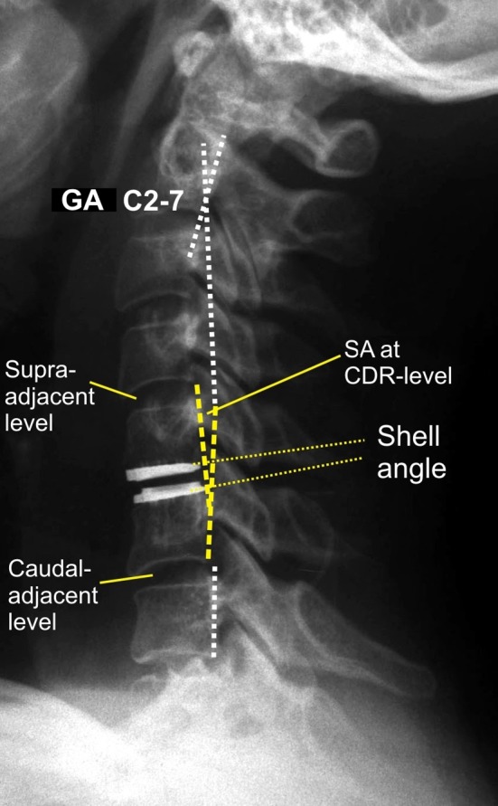 Fig. 2