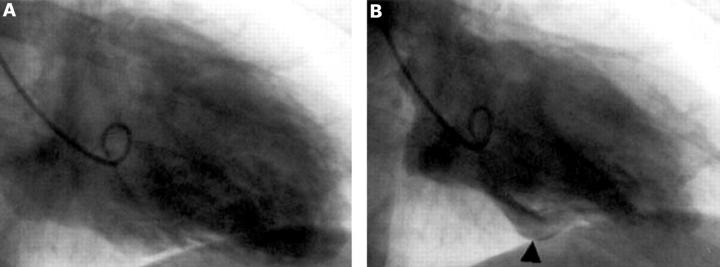 Figure 2  