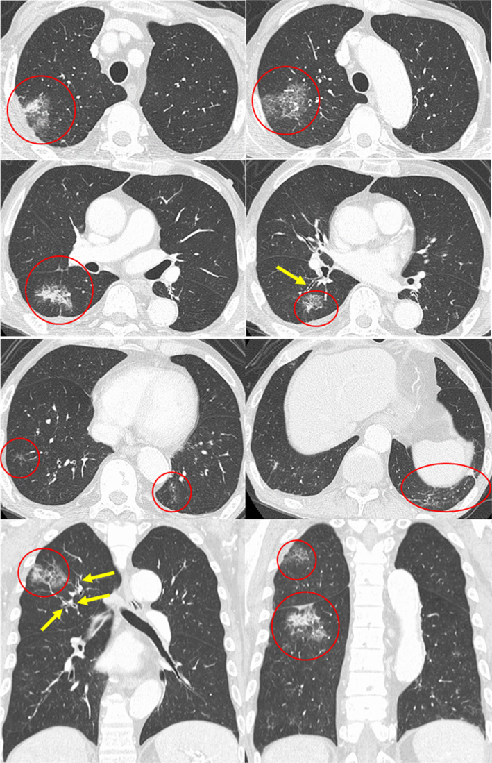 FIGURE 2