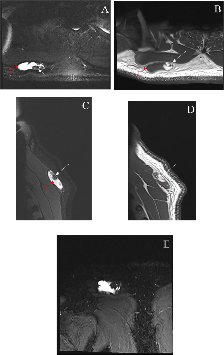 Fig1