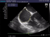 Fig. (5)