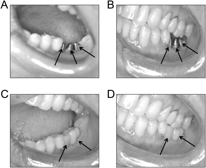 Fig 3