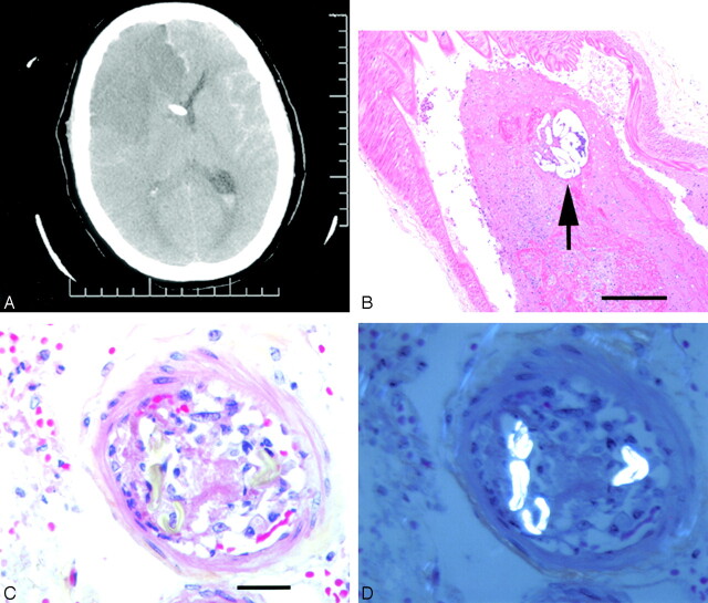 Fig 1.