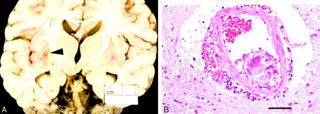 Fig 2.