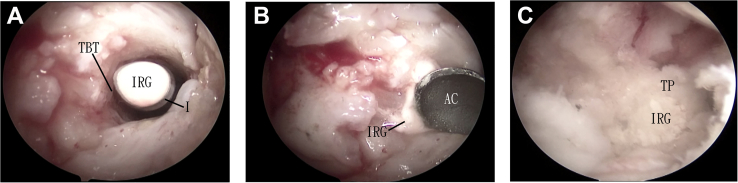 Fig 6
