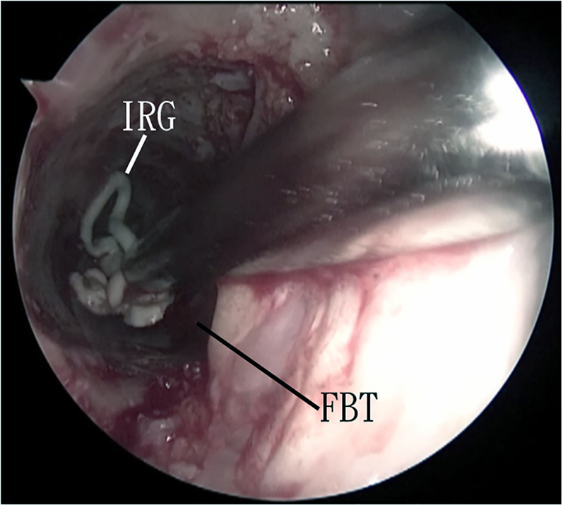 Fig 5