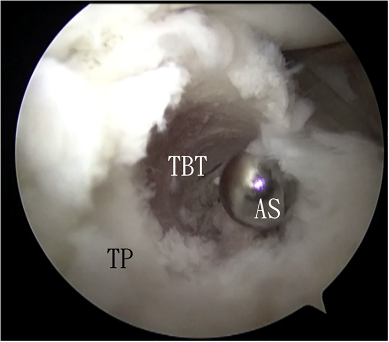 Fig 4