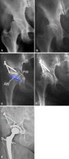 Fig. 6A–E