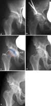 Fig. 5A–E