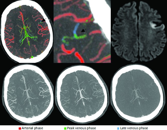 FIG 4.