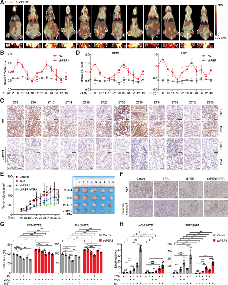 Figure 4. The interference of PER1 reverses trastuzumab resistance in gastric cancer. A, Stably transfected NCI-N87TR cells with control (left) or PER1 knockdown (right) were subcutaneously injected into nude mice. Glycolysis level was measured by 18F-FDG PET-CT at ZT2 to ZT46. MicroPET-CT images of whole nude mice are shown above, whereas PET images of 18F-FDG uptake by tumors is shown below. White circles present the tumor location. B, Quantification of mean standard uptake value (SUV; n = 3). C, Representative IHC images of PER1 and HK2 expression on serial sections were presented at indicated ZTs; scale bar, 100 µm. D, Quantitative analysis of relative IHC level of PER1 and HK2 (n = 4). E, Tumor growth (left) and representative images (right) of transplanted subcutaneous tumors with PER1 knockdown and trastuzumab treatment (TRA, 10 mg/kg, twice a week). F, Representative IHC images of Ki67 and Cleaved-caspase3 on serial sections of subcutaneous tumors of xenograft nude mice; scale bar, 140 µm. G and H, Growth inhibition (G) was detected by MTT assay and cell death (H) was detected by Calcein-AM/PI assay in TR cells treated with trastuzumab (TRA, 10 µg/mL), 2DG (4 mmol/L), and metformin (MET, 10 mmol/L) after overexpressing PER1. Statistical analysis was performed using 3 (A), 4 (B and G), 5 (E), or 8–10 (H) samples. The Student t test was performed in (G) and (H). One-way ANOVA was performed in (E). Data are graphed as the mean ± SD; ***, P < 0.001; **, P < 0.01; *, P < 0.05; ns, P > 0.05. ANOVA, analysis of variance; 18F-FDG PET-CT, 18F-fluorodeoxyglucose positron emission tomography-computed tomography; SD, standard deviation; TR, trastuzumab-resistant; ZT, Zeitgeber time.