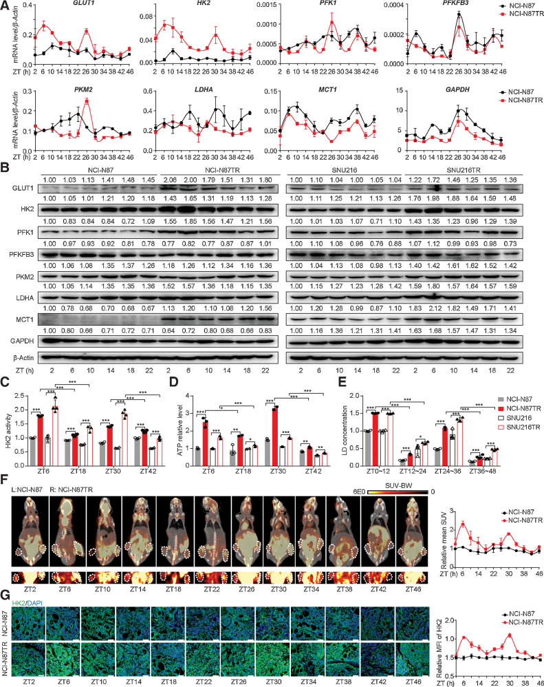 Figure 1. The glycolysis level is upregulated and undergoes circadian oscillations in trastuzumab-resistant HER2-positive gastric cancer. A, Time-series (every 4 hours) expression of glycolysis-related genes determined by qPCR in synchronized NCI-N87 and NCI-N87TR gastric cancer cells. Cells were synchronized by dexamethasone (100 nmol/L) for 2 hours, which was replaced with fresh medium (this time as ZT0), and then harvested from 2 to 46 hours with 4 hours intervals. B, WB analysis of glycolysis-related genes in WT and TR cells at the indicated ZT2 to ZT22. β-Actin serves as the loading control. C–E, The HK enzyme activity (C), ATP level (D), and lactic acid concentration (E) in the synchronized WT and TR cells were detected at ZT6, ZT18, ZT30, and ZT42. F, NCI-N87 WT (left) and TR (right) cells were subcutaneously injected into the abdominal of nude mice for 1 month. Glycolysis level in tumors was measured by 18F-FDG PET-CT at ZT2 to ZT46 (left), and mean standard uptake value (SUV) was quantified (right, n = 2). MicroPET-CT images of whole nude mice are shown above, whereas PET images of 18F-FDG uptake by the tumor are presented below. White circles present the tumor location. G, IF analysis for HK2 expression in WT and TR tumor tissues. Representative IF images (left) and the quantification (right) of mean fluorescence intensity (MFI) are shown (n = 4); scale bar, 50 µm. Statistics were calculated with 3 (A and D) or 4 (C and E) samples. Student t test was performed in (C–E). Data are presented as mean ± SD. ****, P < 0.001; ***, P < 0.001; **, P < 0.01; *, P < 0.05; ns, P > 0.05. ATP, adenosine triphosphate; 18F-FDG, 18F-fluorodeoxyglucose; 18F-FDG PET-CT, 18F-fluorodeoxyglucose positron emission tomography-computed tomography; HER2, human epidermal growth factor receptor 2; HK2, hexokinase 2; IF, immunofluorescence; qPCR, quantitative polymerase chain reaction; SD, standard deviation; TR, trastuzumab-resistant; WB, Western blotting; WT, wild type; ZT, Zeitgeber time.