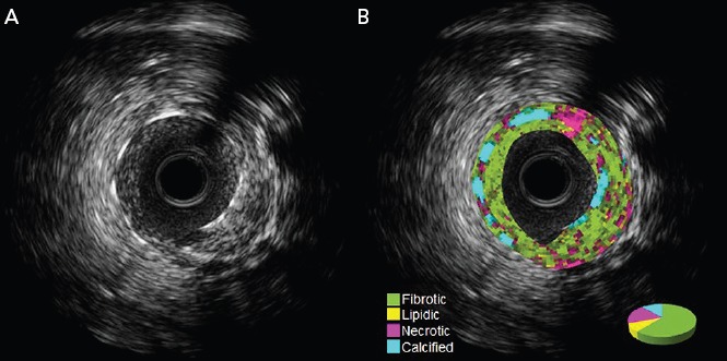 Figure 4: