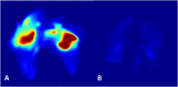 Fig. 3 A-B
