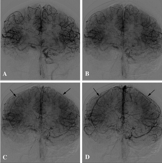 Fig 1.