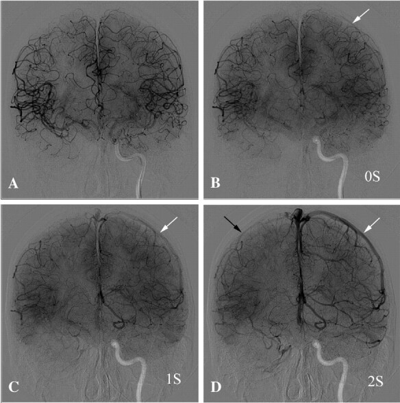 Fig 2.