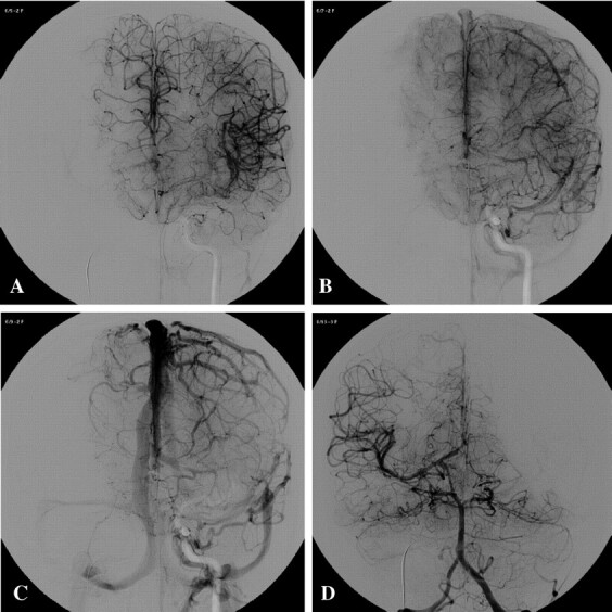 Fig 3.