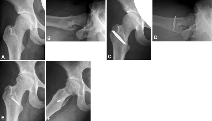 Fig. 5A–F