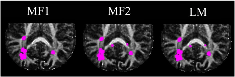 Fig. 11