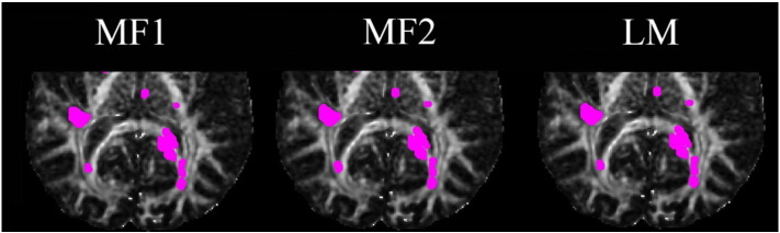 Fig. 9