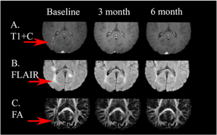 Fig. 10