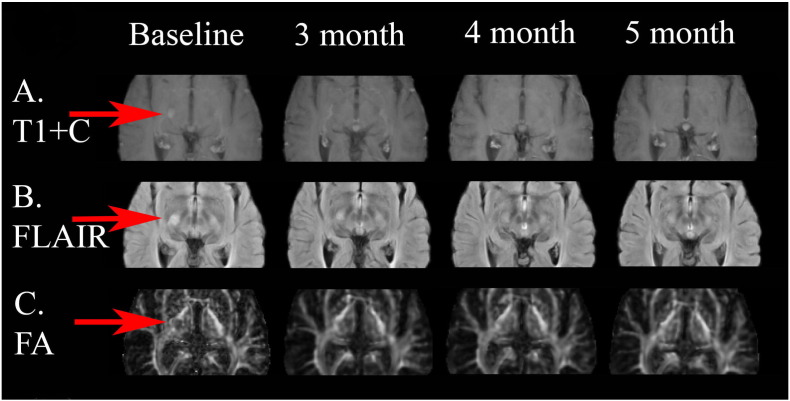 Fig. 4