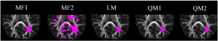 Fig. 7