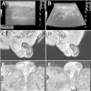 Fig. 1