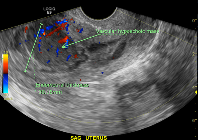 FIGURE 1