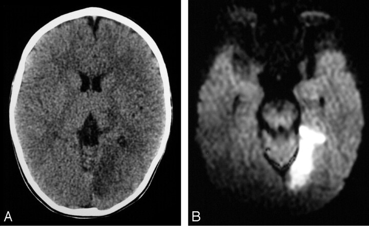 Fig 3.