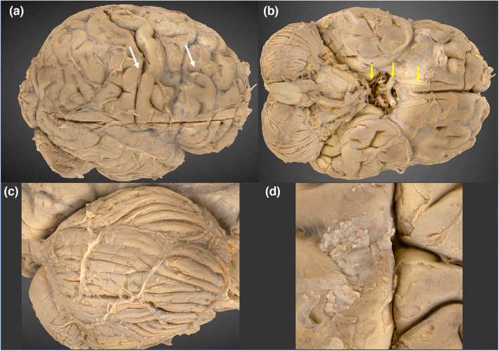 FIGURE 4