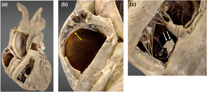 FIGURE 3