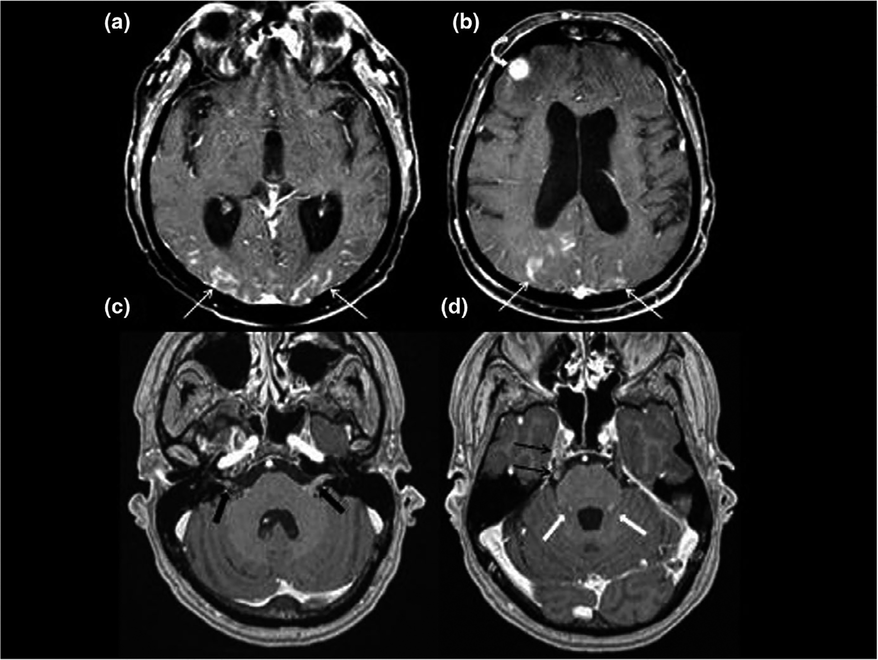 FIGURE 2